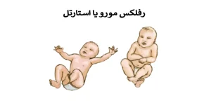 رفلکس مورو یا استارتل – بخش دوم