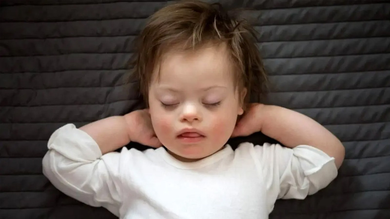 تفاوت هزینه های درمان کودکان سندروم داون و اوتیسم