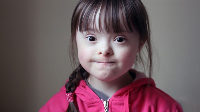 تفاوت کودکان سندروم داون با اوتیسم در طول عمر کودکان