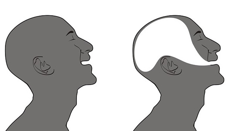 انواع دیزآرتری و ویژگی ‌هایشان